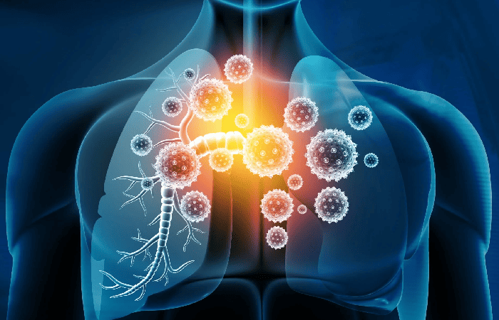 Discover Long Covid And Understand How SARS-CoV-2 Tricks With Your Pain